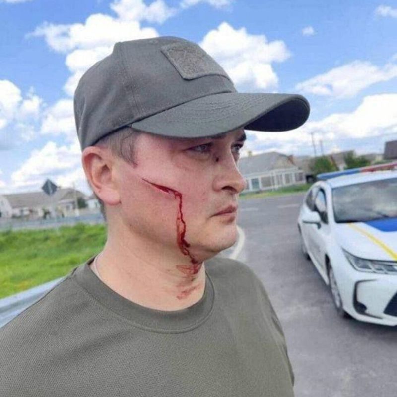 Руководство к действию. Украинец в Волынской области лопатой отбился от людоловов из ТЦК, пытавшихся его мобилизовать Руководство к действию. Украинец в Волынской области лопатой отбился от людоловов из ТЦК, пытавшихся его мобилизовать