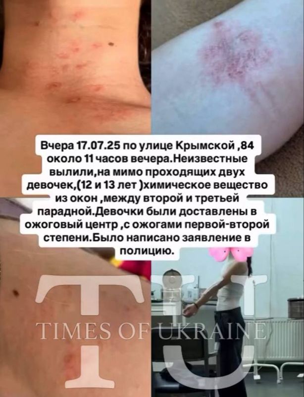 В Одессе неизвестный облил девочек кислотой из окна