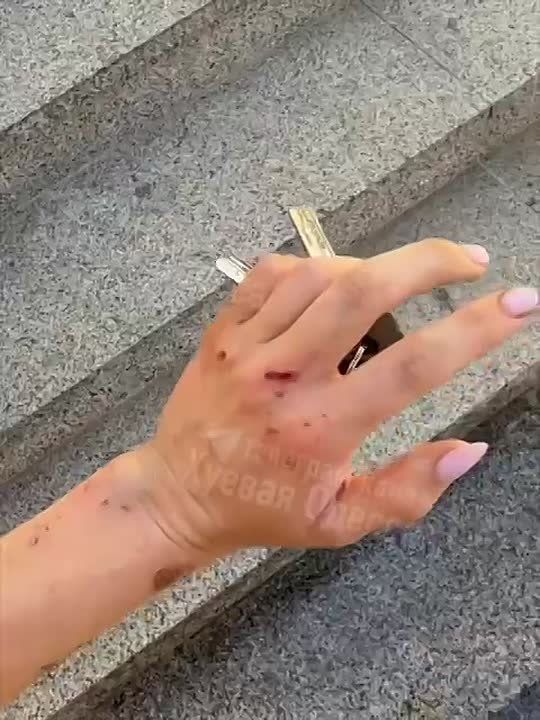 В Одессе девушка сломала руку, убегая от насильника