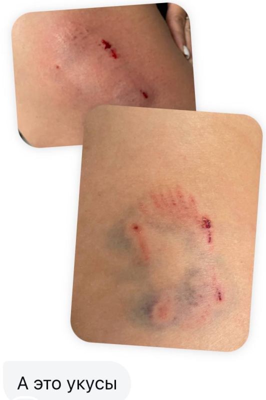 В Черноморске пёсель покусал женщину В Черноморске пёсель покусал женщину