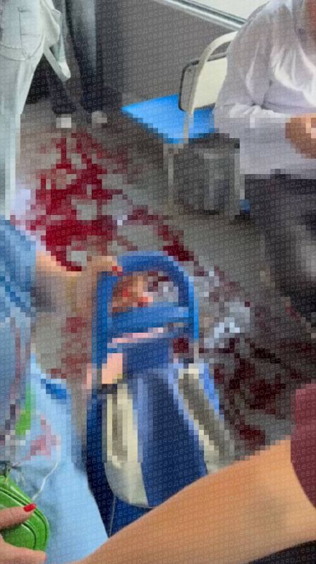 В Одессе водитель трамвая зажал пенсионерке ногу