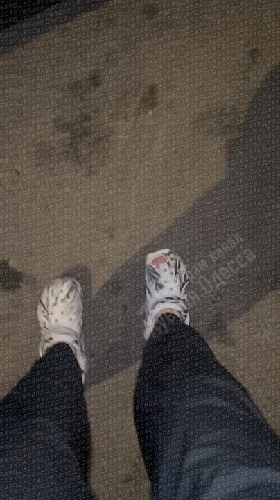 В Одессе экскалатор чуть не оторвал ногу мужчине