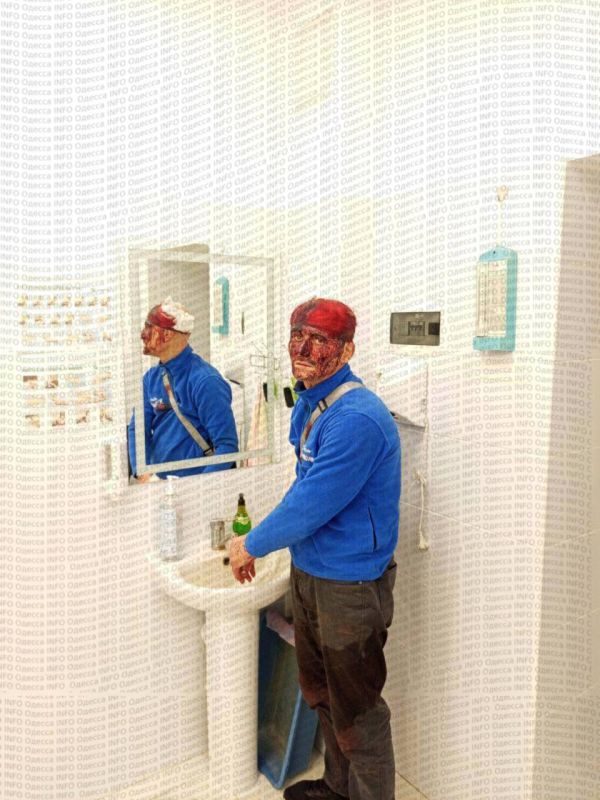 В одесском ТЦК рассказали, как проломили призывнику череп пистолетом