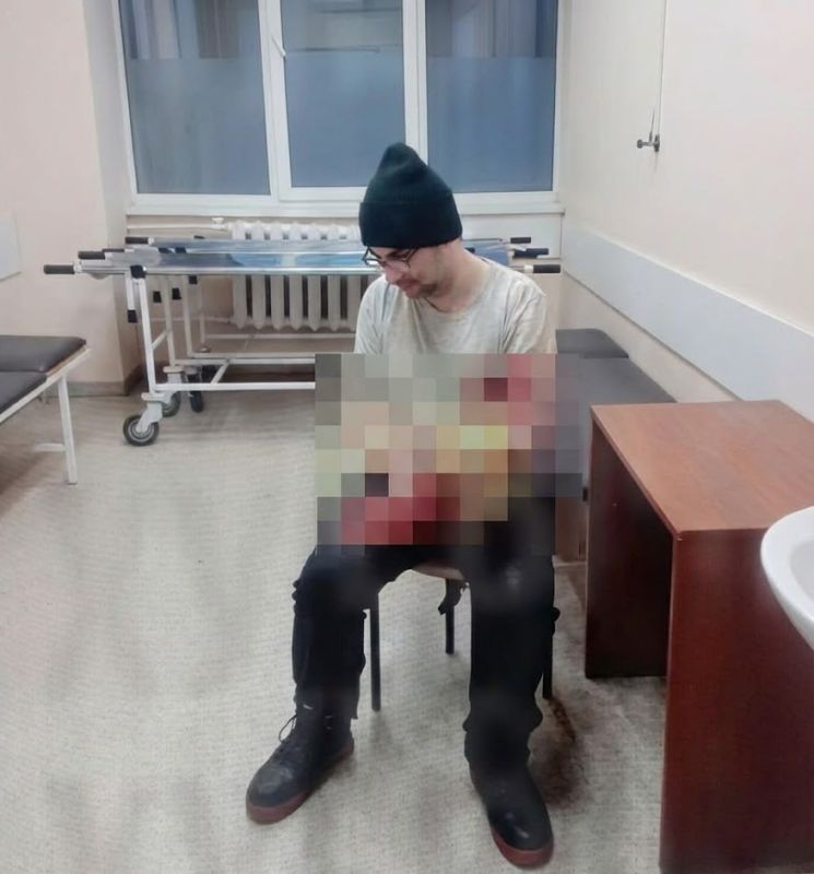 В Одессе мужчина попытался отпилить себе руку, чтобы не попасть под мобилизацию