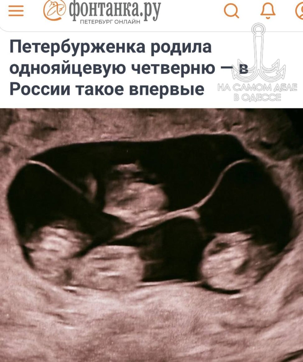 Редчайшее явление в генетике и репродуктивной медицине, если верить изданию «Фонтанка», зафиксировано в Петербурге