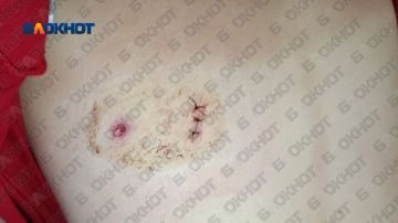 � ����������� ������ 43-������ ������� ��������� � ����� 15-������ ��������� �� �������������� ��������