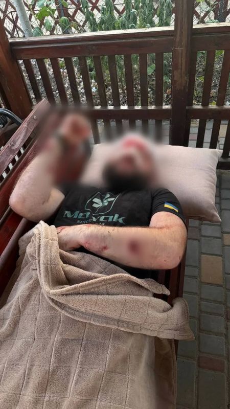 Украинский военный требовал выключить русскоязычные песни и получил арматурой по голове