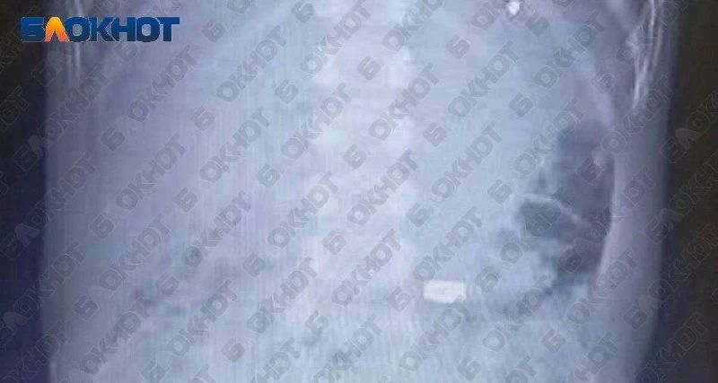 В Одессе врачи спасли трёхлетнего ребёнка, проглотившего батарейку В Одессе врачи спасли трёхлетнего ребёнка, проглотившего батарейку